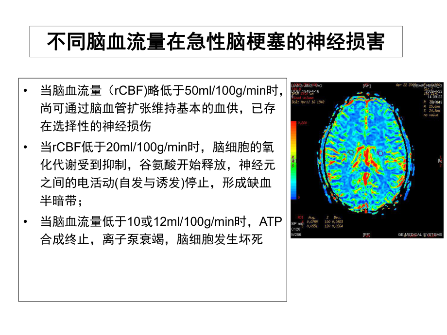 最新急性脑梗死rtPA溶栓治疗主题讲座课件.ppt_第3页