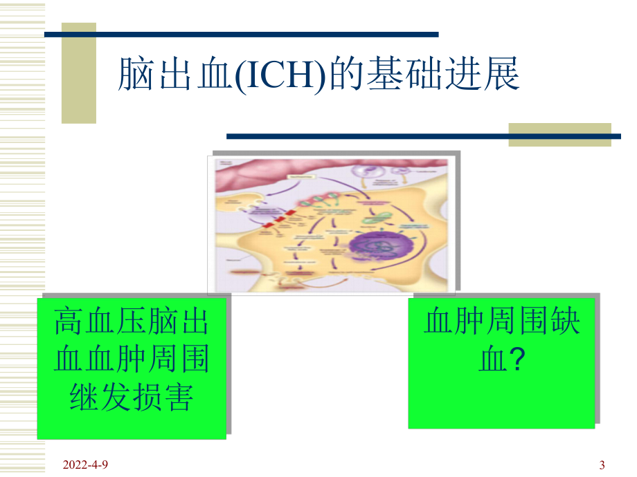 脑出血预防与防治课件.ppt_第3页