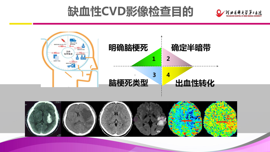 脑卒中的影像诊断治疗课件.ppt_第2页