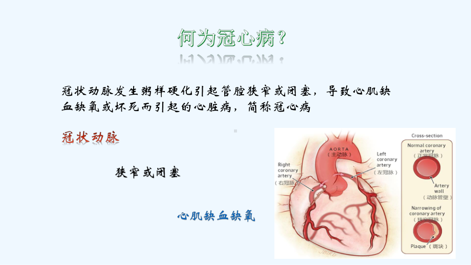 心脑血管疾病1课件.pptx_第3页