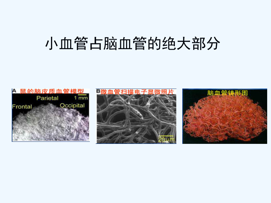 脑小血管病影像课件.ppt_第3页