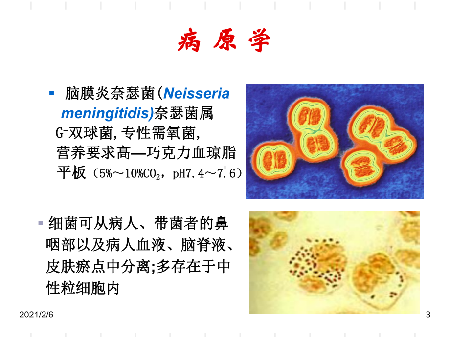 流行性脑脊髓膜炎2课件.ppt_第3页