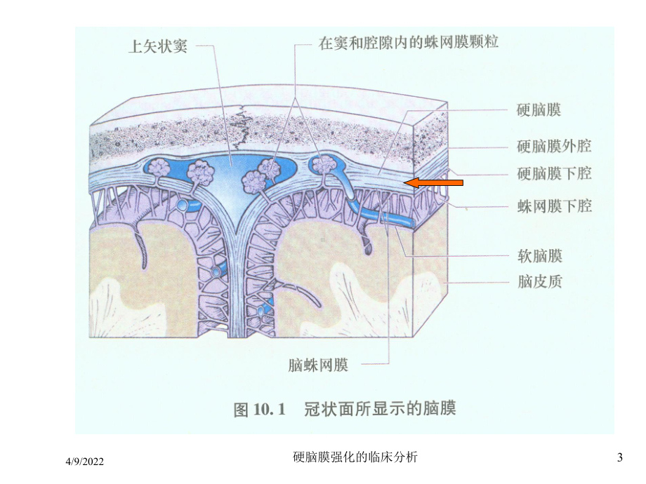 硬脑膜强化的临床分析培训课件.ppt_第3页