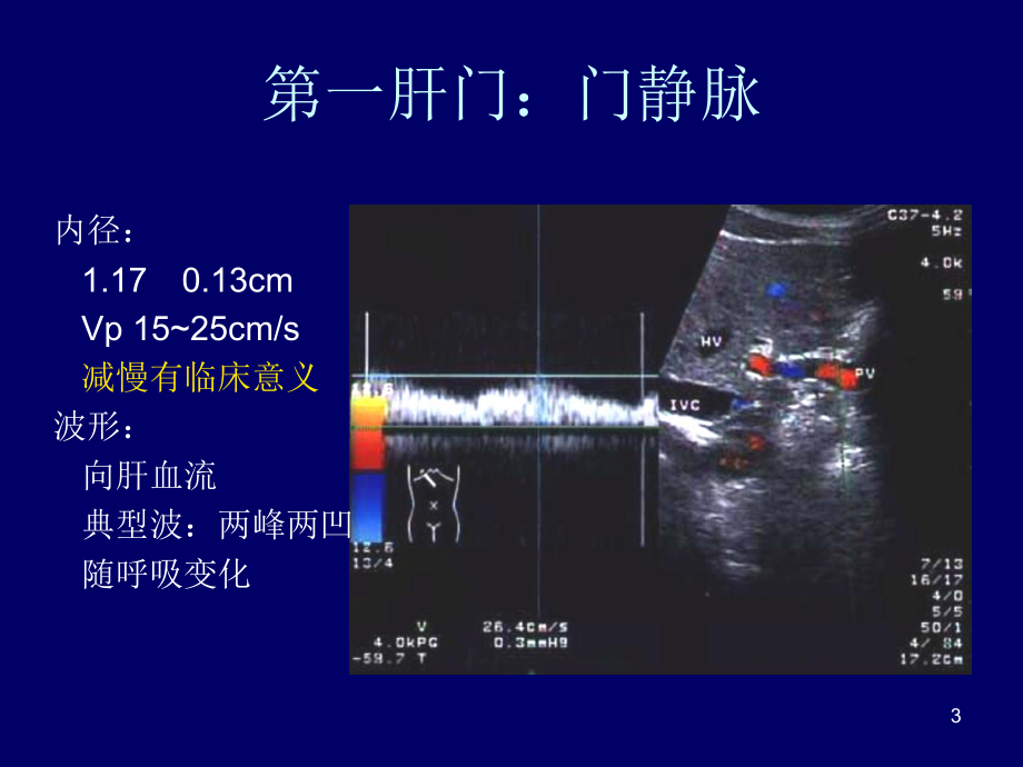 影像B超图谱肝胆超声诊断学ppt课件.ppt_第3页