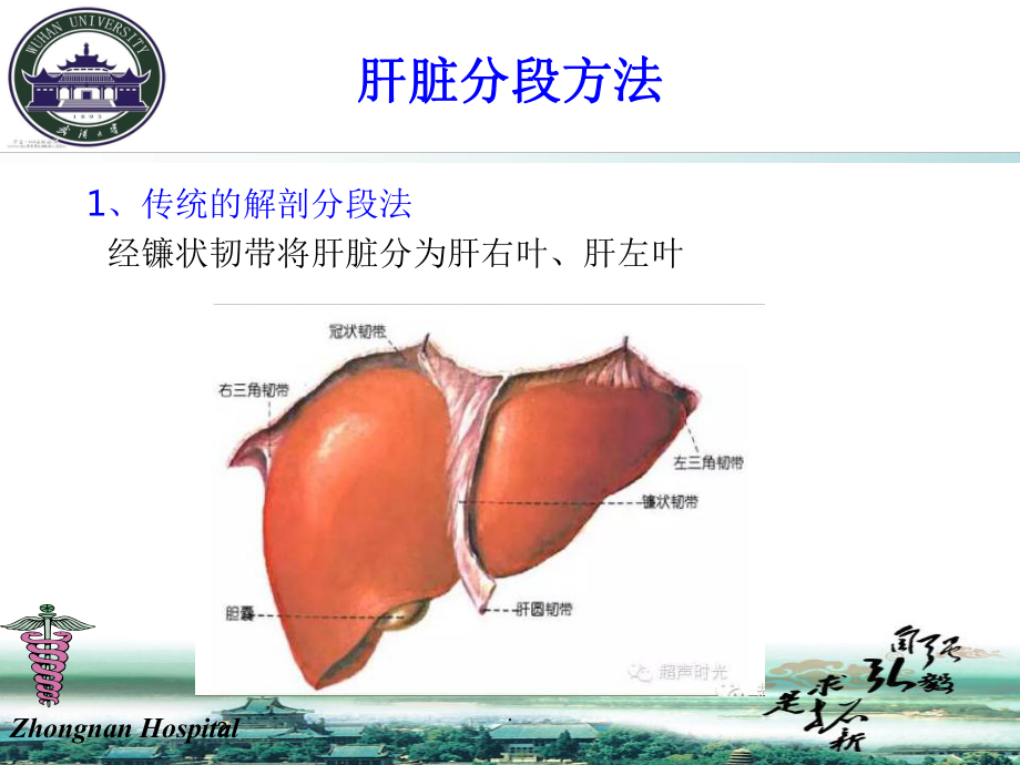 肝脏分段解剖课件.ppt_第2页