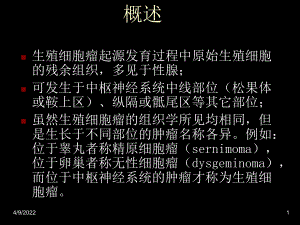 脑生殖细胞瘤25页PPT课件.ppt