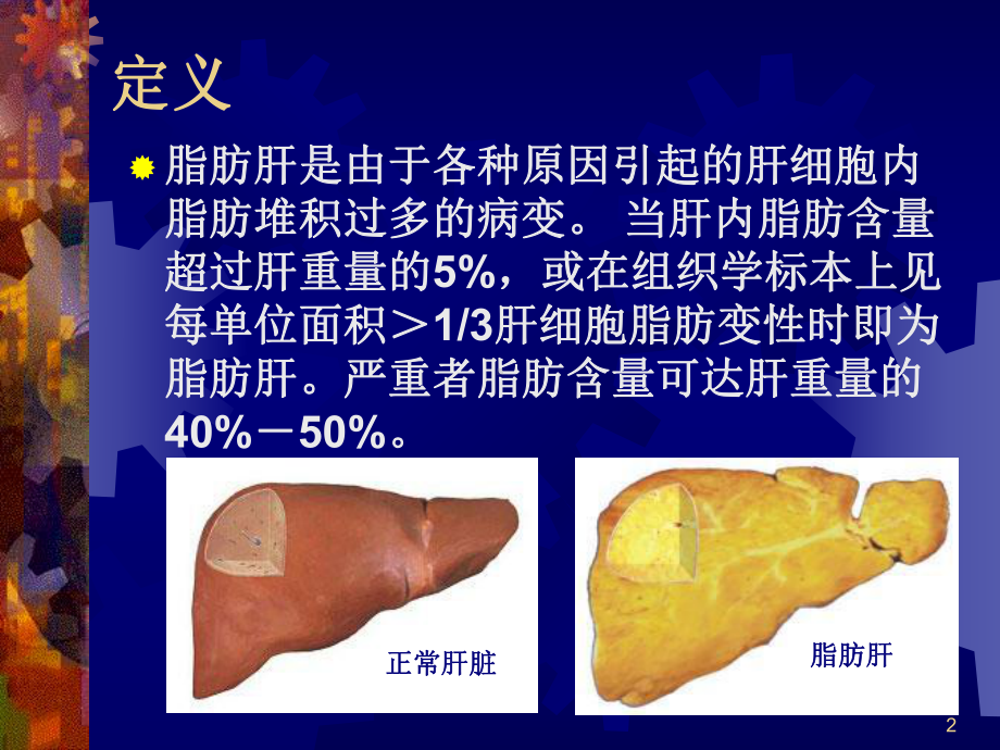 脂肪肝的营养治疗PPT演示课件.ppt_第2页