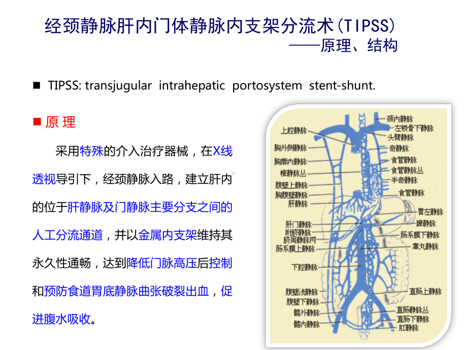 经颈静脉肝内门体分流术(TIPS)课件.ppt_第3页