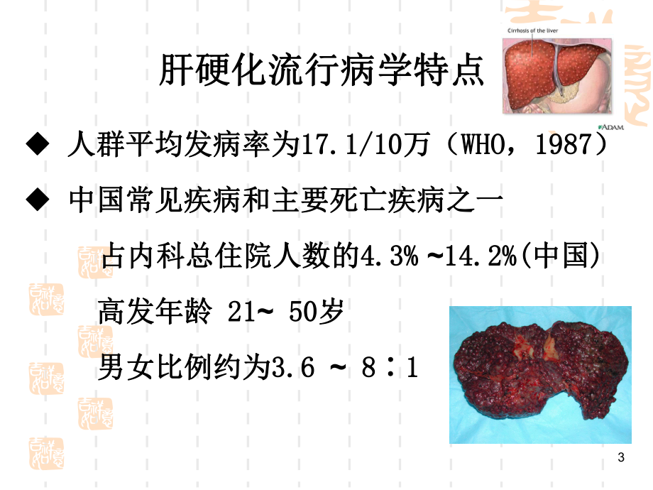 肝硬化病人的护理-ppt课件.ppt_第3页