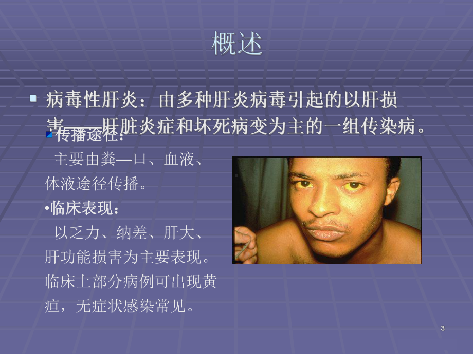 病毒性肝炎病人的护理ppt课件(同名50).ppt_第3页