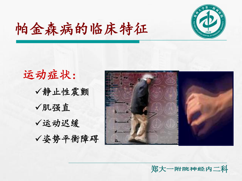 神经内科常见病的诊治及药物合理应用1课件.ppt_第3页