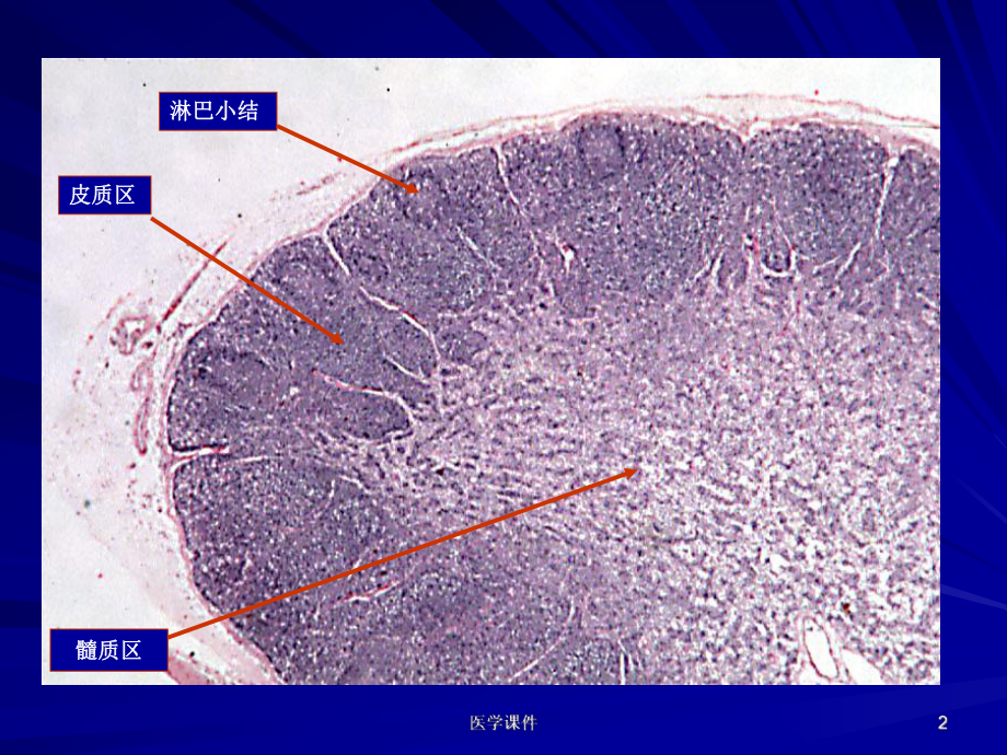 《病理学》实验-内分泌-淋巴造血-神经系统-P课件.ppt_第2页