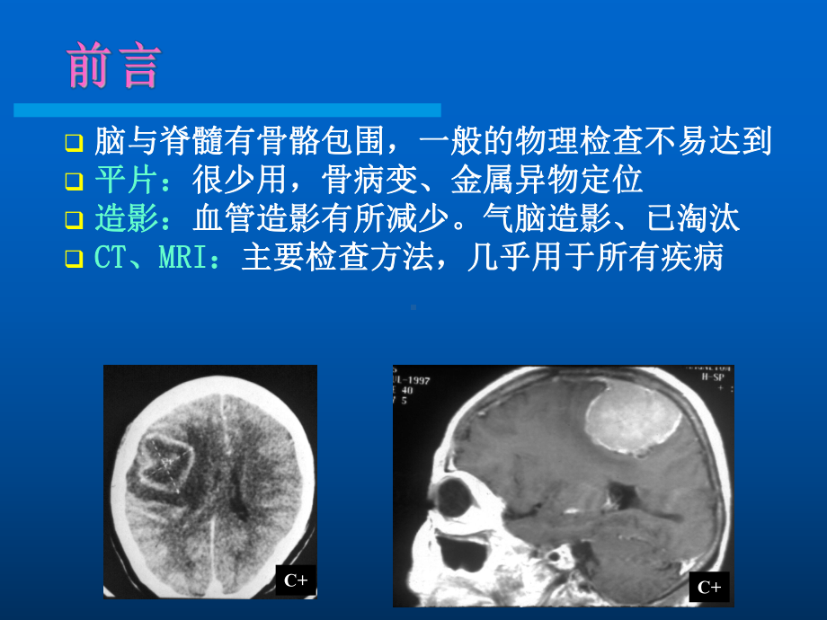 医学影像学中枢神经系统课件.ppt_第2页