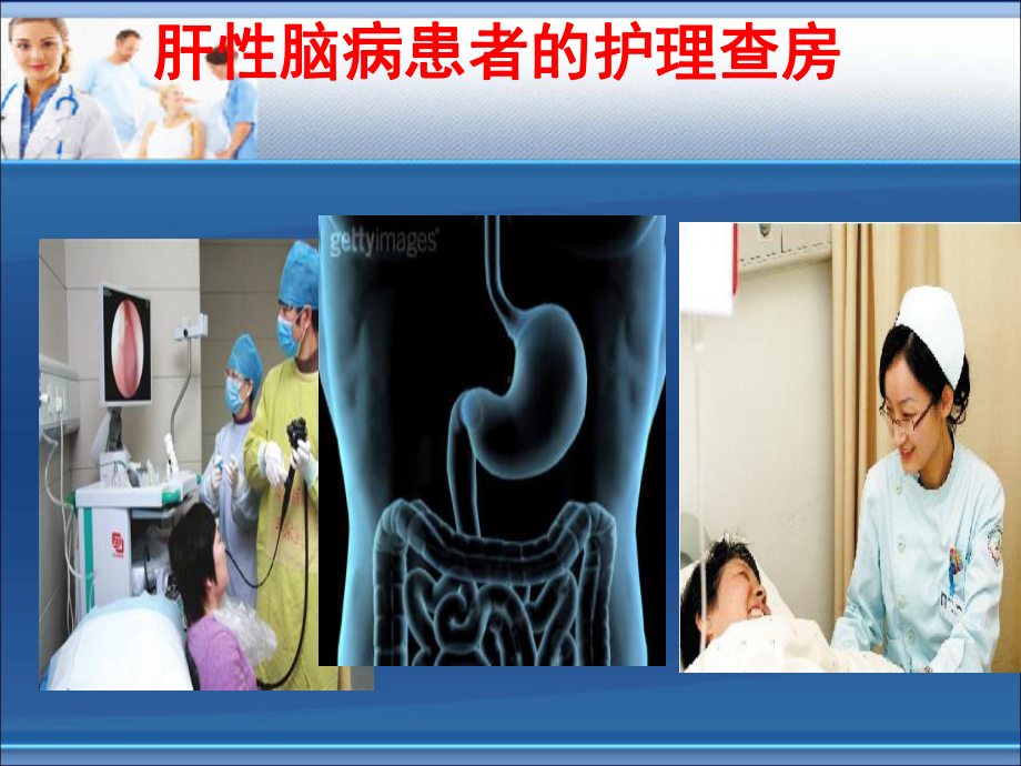 肝性脑病护理查房课件.ppt_第1页