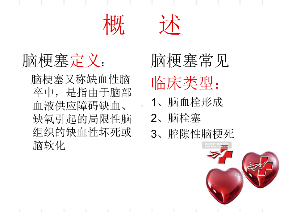 脑梗塞护理常规详细课件.ppt_第2页