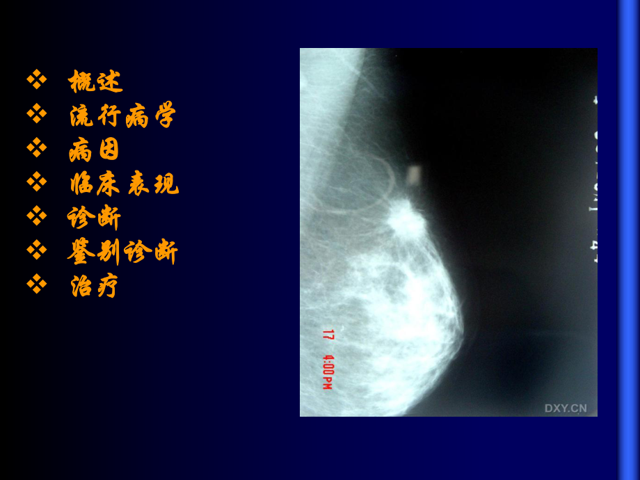 乳腺神经内分泌肿瘤诊断治疗现状附例病案分析课件.ppt_第2页