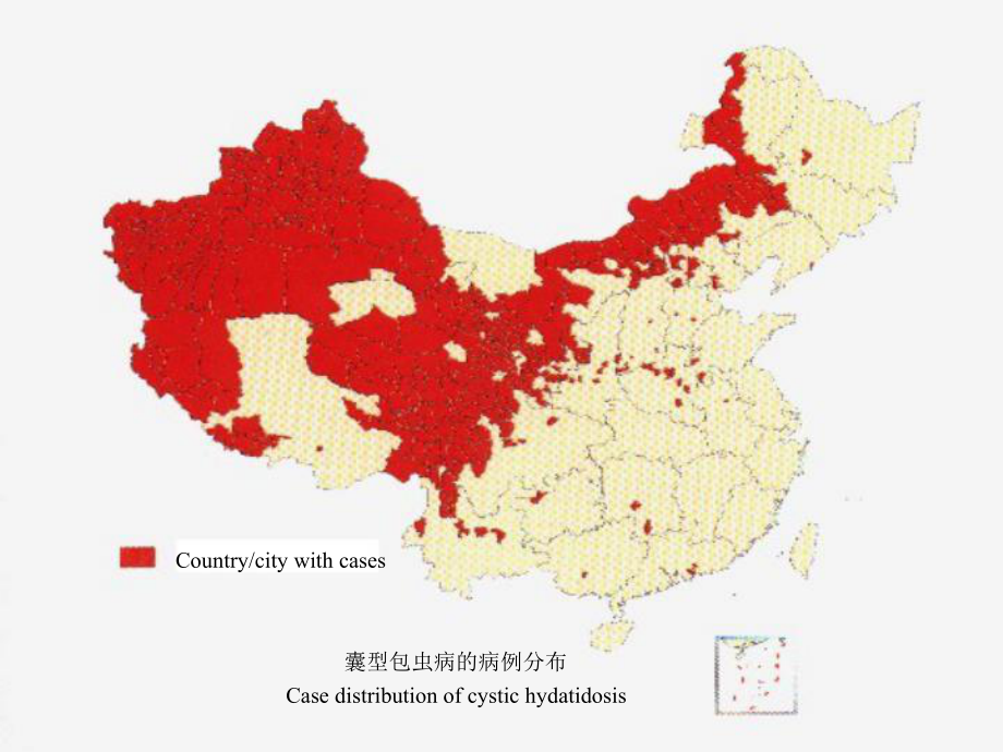 肝包虫病的超声诊断课件.ppt_第3页