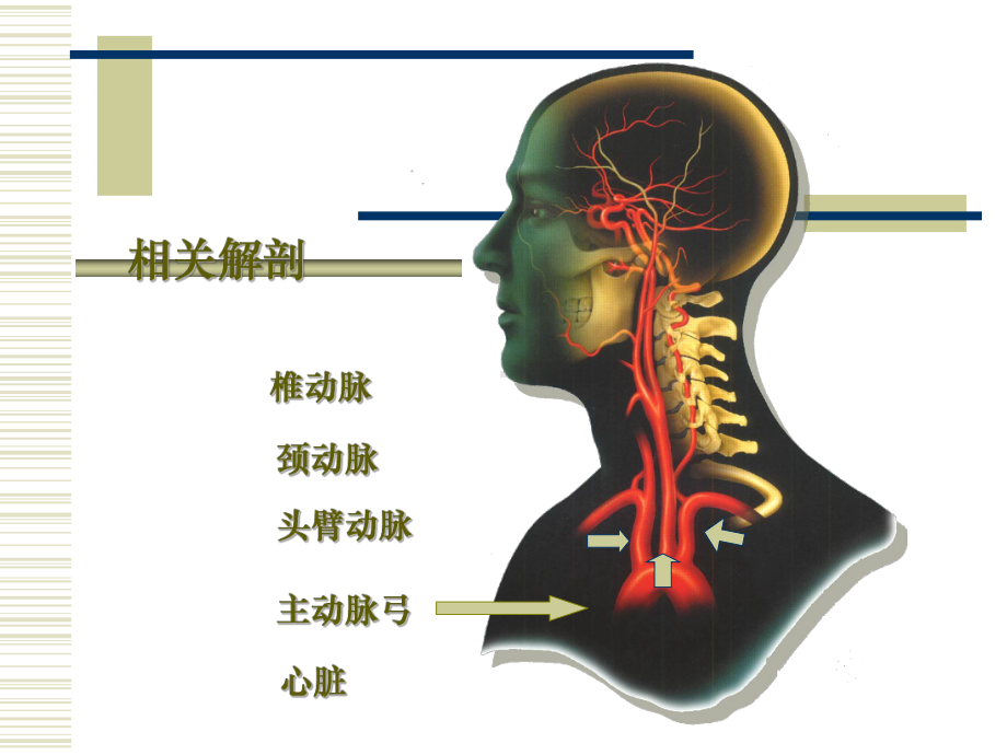 缺血性脑血管病的介入治疗课件.ppt_第2页