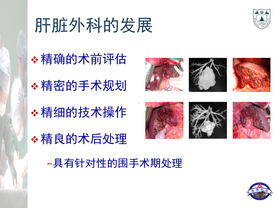 精准肝切除的围手术期处理课件.ppt_第3页