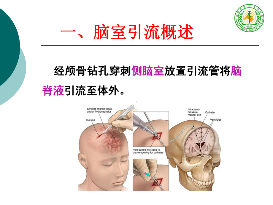 脑室引流管的护理查房PPT课件.ppt_第3页