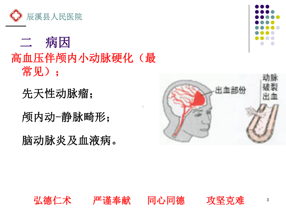 脑出血的健康教育ppt课件.ppt_第3页