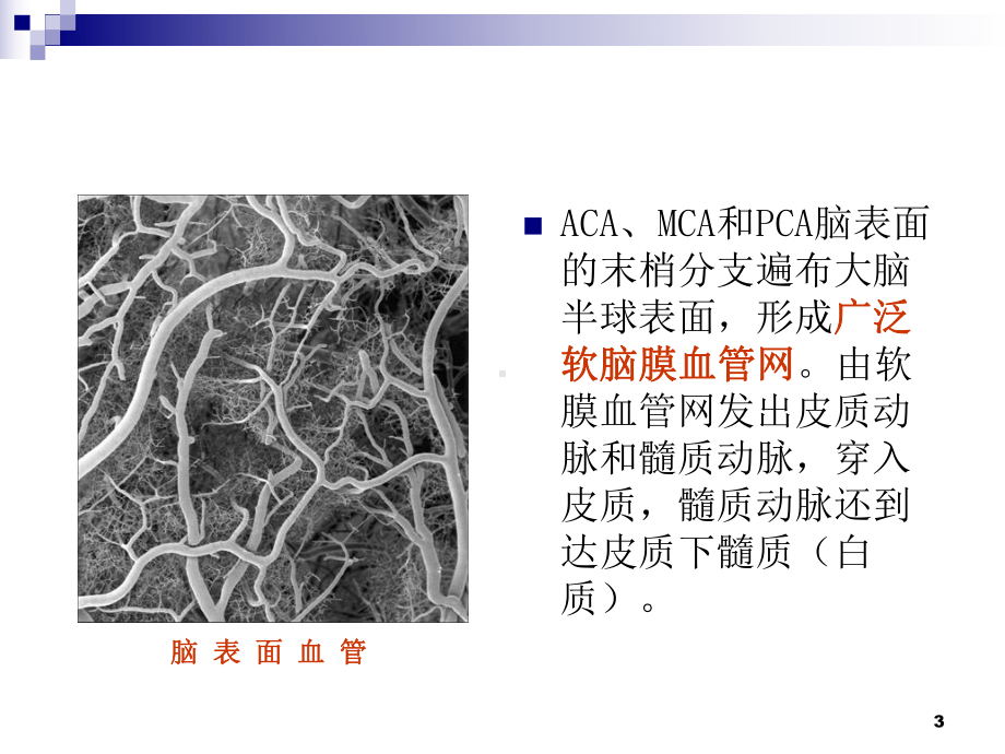 脑分水岭梗死PPT课件.ppt_第3页