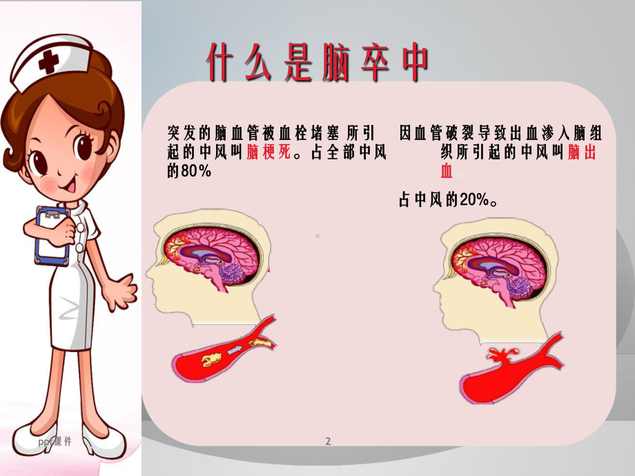 脑卒中护理查房-ppt课件.ppt_第2页