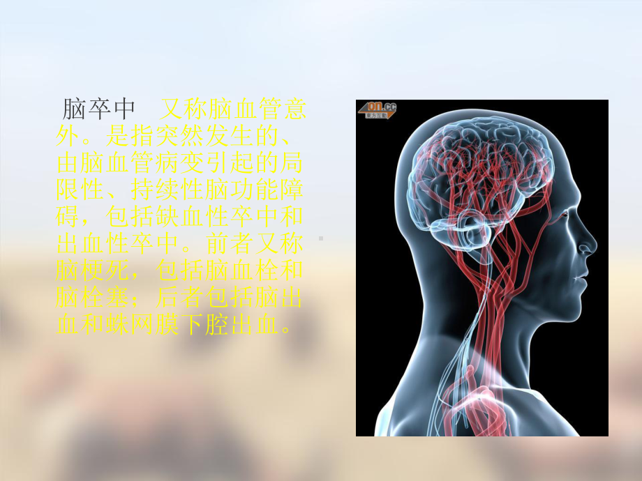 脑卒中早期康复课件.ppt_第2页