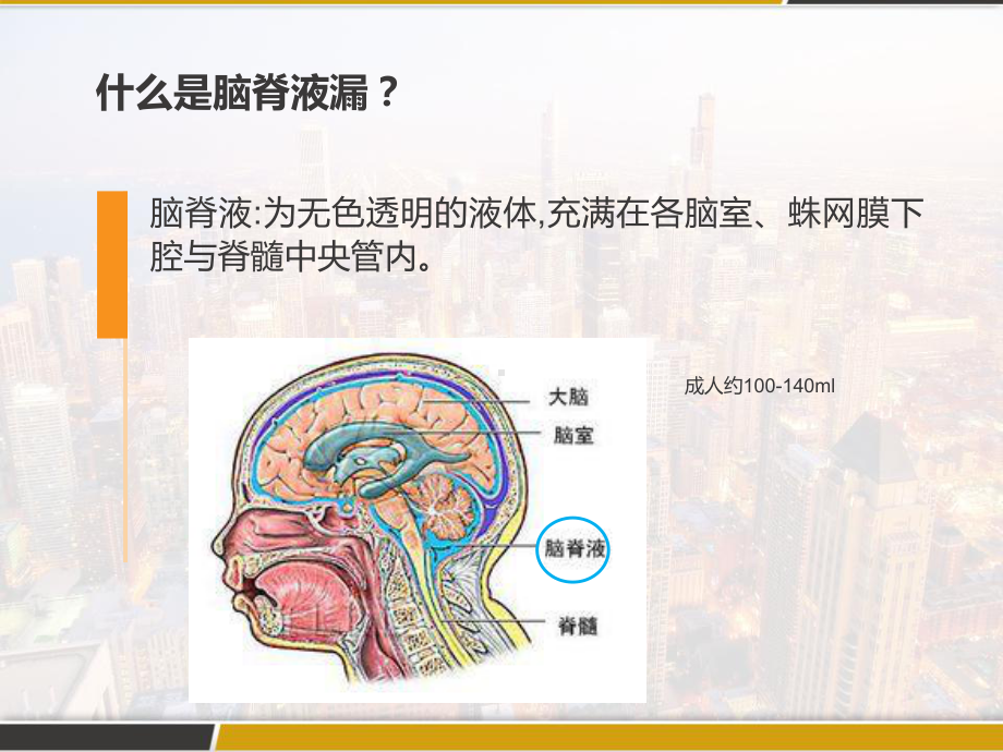 脑脊液漏的观察与护理-PPT课件.pptx_第3页