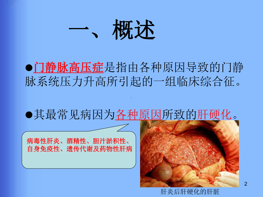 肝硬化门静脉高压食管胃静脉曲张出血的防治共识PP课件.ppt_第2页