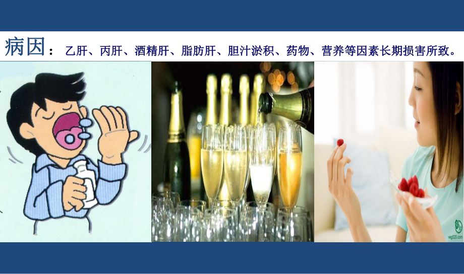 肝硬化健康教育ppt课件.ppt_第3页