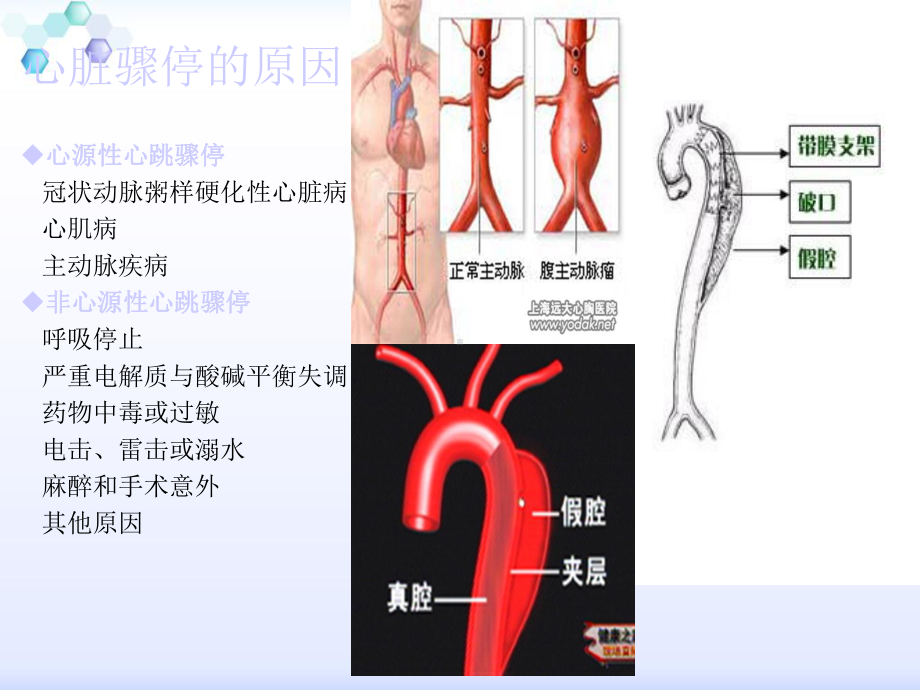 急危重症护理学-第五章-心脏骤停与心脑肺复苏课件.ppt_第3页