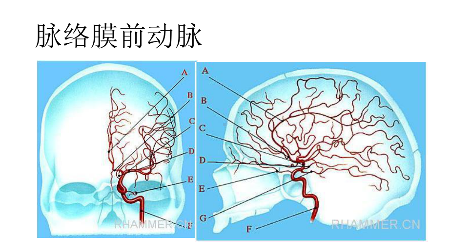 脑动脉解剖及临床(脉络膜前动脉)课件.ppt_第2页