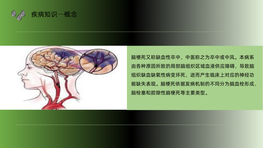 多发性脑梗死护理查房PPT课件.ppt_第3页