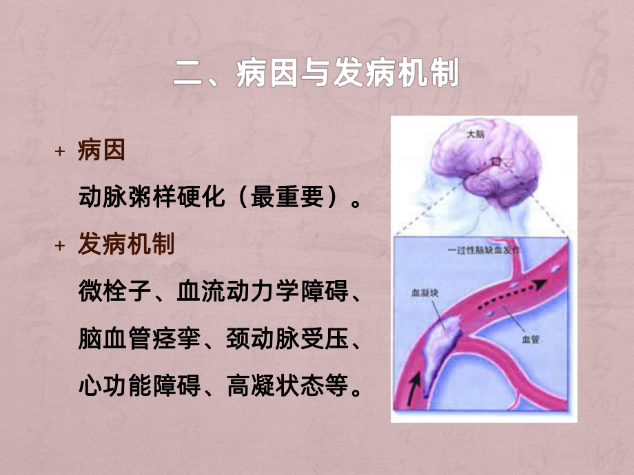 短暂性脑缺血发作ppt课件.pptx_第3页