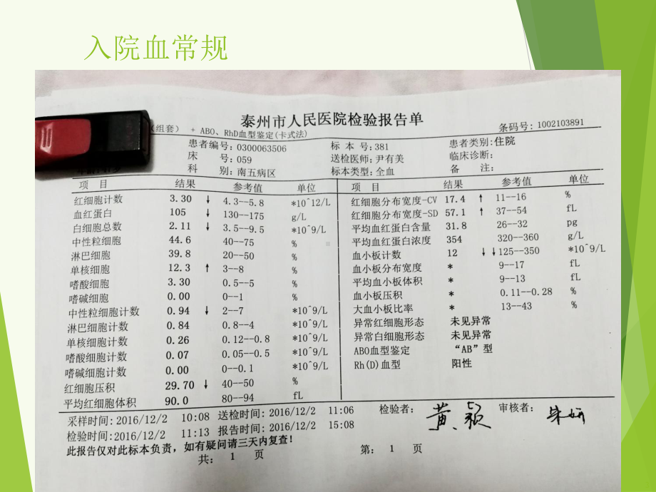 肝硬化病例分享ppt课件.ppt_第3页