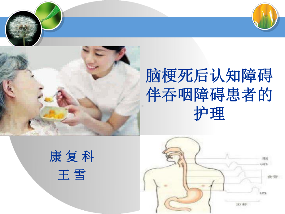 脑梗死后认知障碍伴吞咽障碍患者的护理查房课件.ppt_第1页