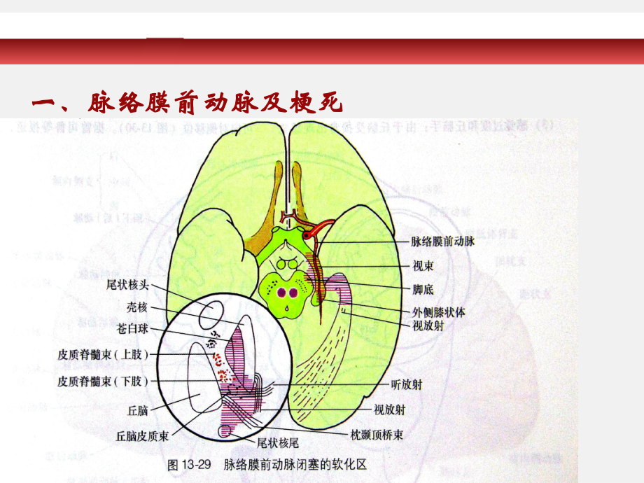 脑动脉各支供血区分布-ppt课件.ppt_第3页