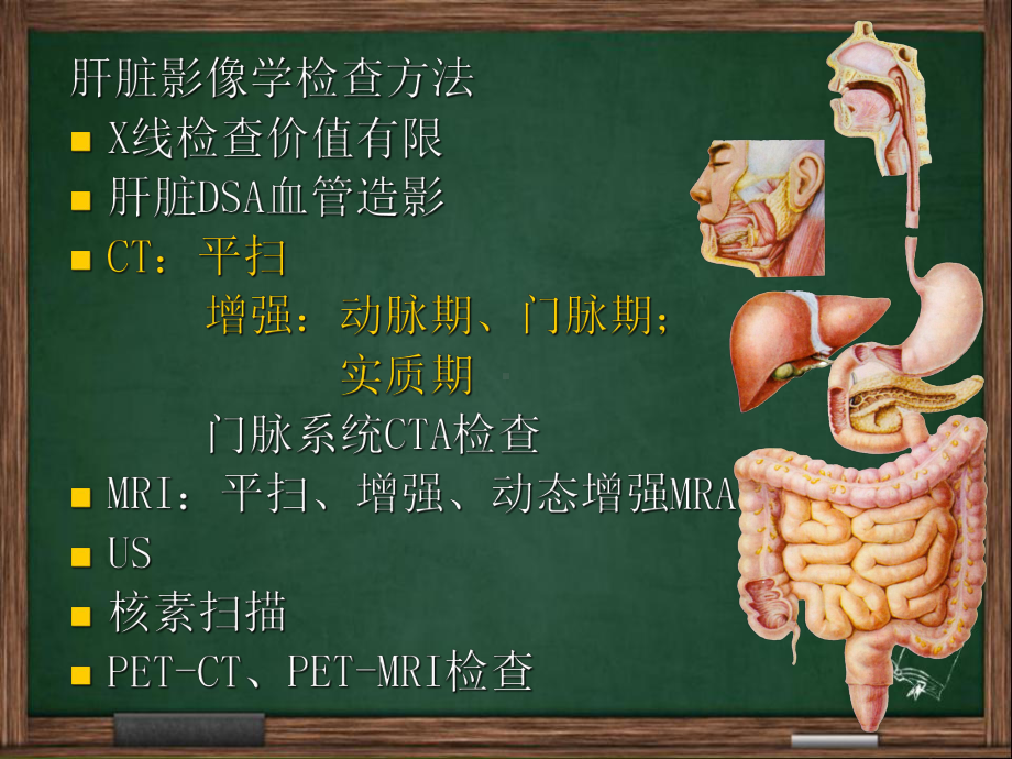 肝脏CT诊断-PPT课件.ppt_第2页