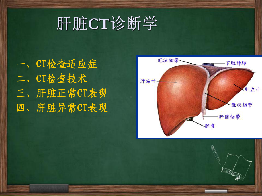 肝脏CT诊断-PPT课件.ppt_第3页