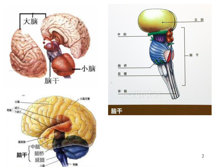 脑干综合征PPT课件.ppt_第2页