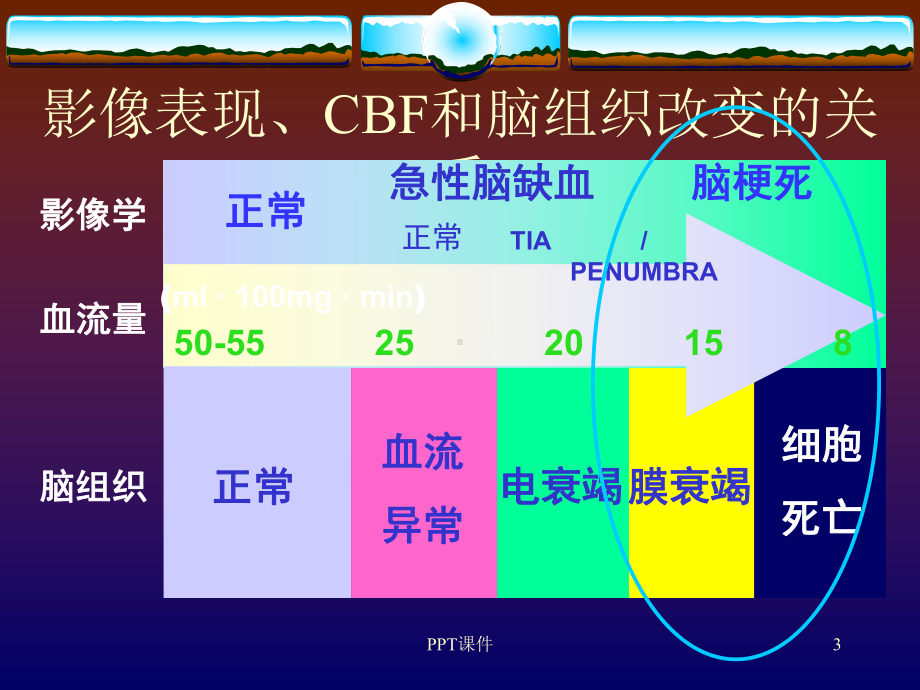 脑血管狭窄的诊断及治疗-ppt课件.ppt_第3页