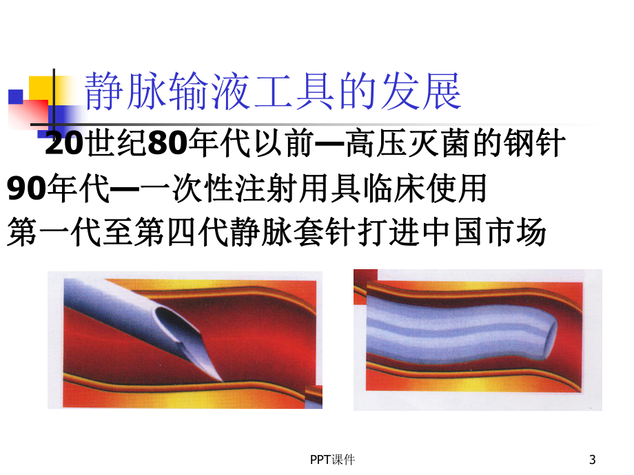 静脉输液工具合理选择-ppt课件.ppt_第3页