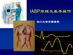 IABP原理及基本操作PPT课件.ppt