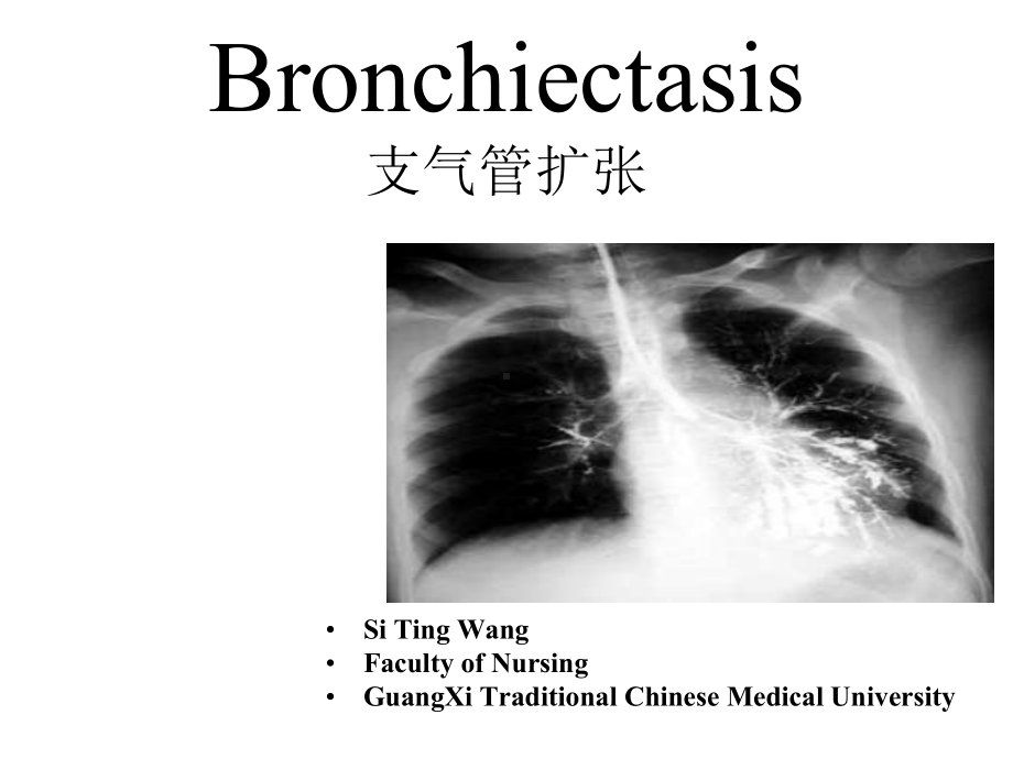 内科护理学课件-英语-考试Bronchiectasis.ppt_第1页