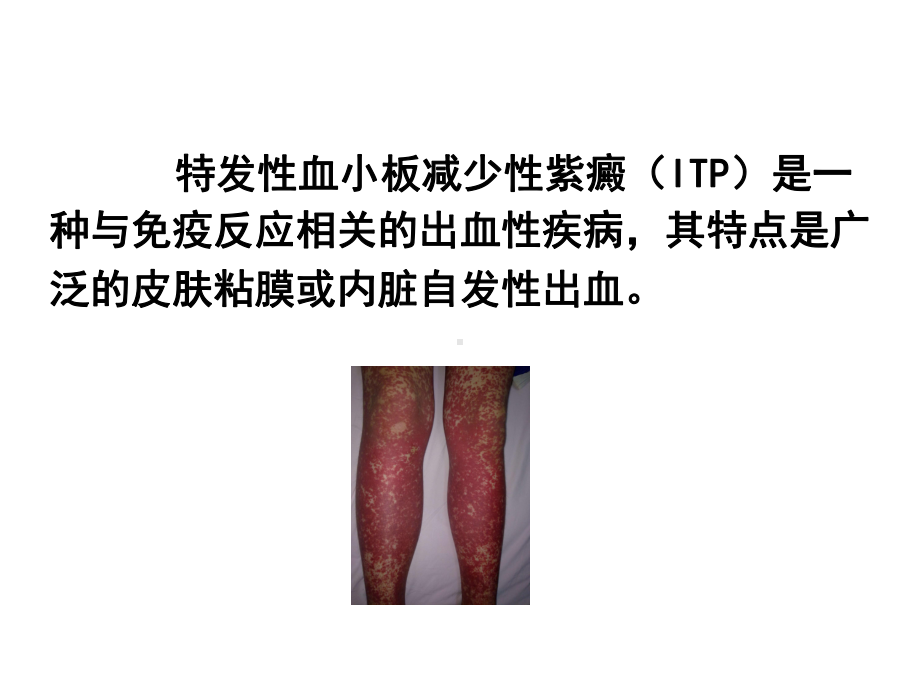 内科护理学《第六章血液系统疾病患者的护理》第三节-ITP患者的护理课件.ppt_第3页