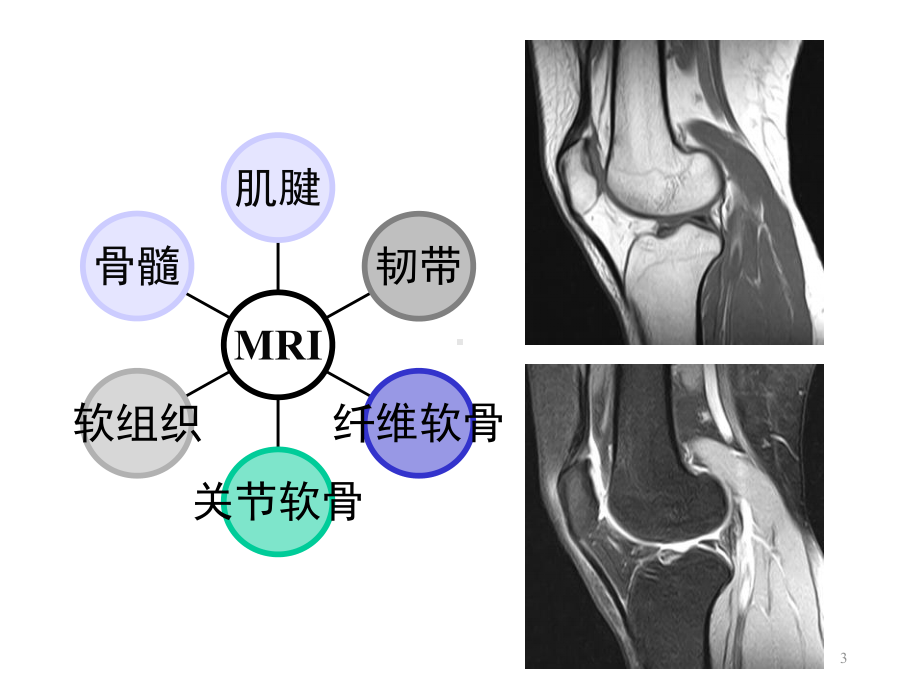 关节磁共振检查技术与诊断课件.ppt_第3页