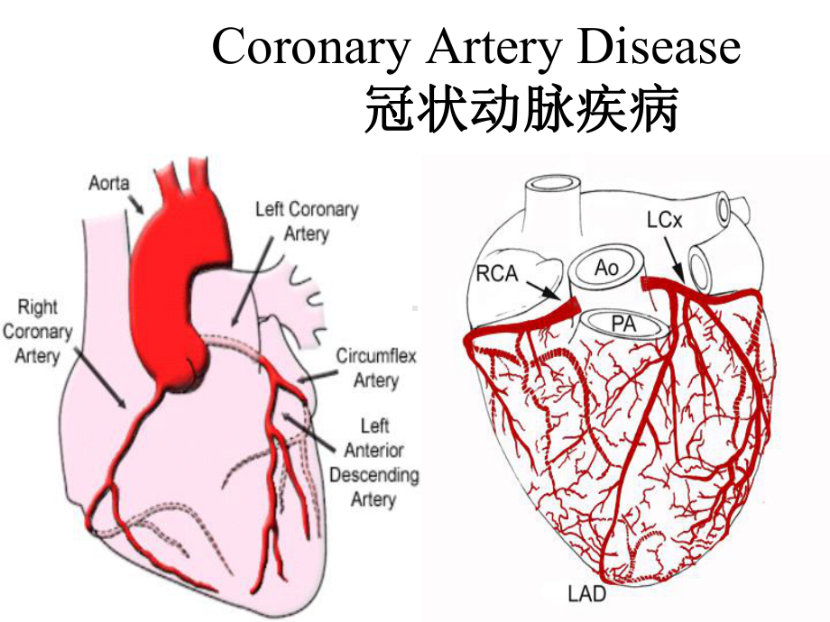 内科护理学课件-英语-考试Coronary-Artery-Disease.ppt_第1页