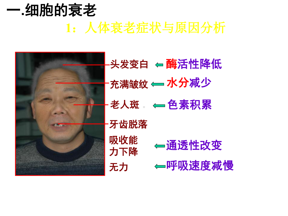 人教版高一生物必修一第六章第三节细胞的衰老和凋亡课件.ppt_第3页