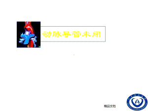 动脉导管未闭课件.ppt